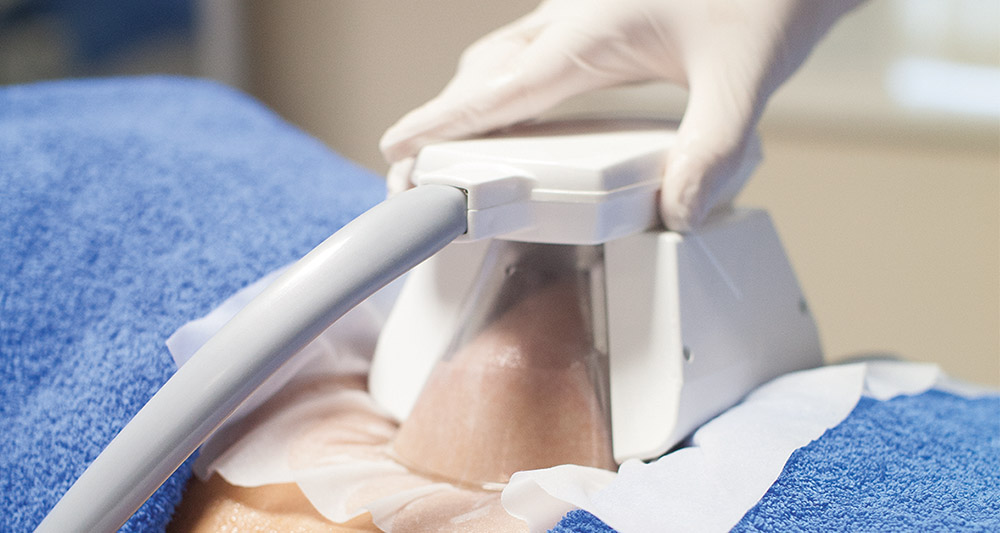 How Fat Freezing and HIFU Work Together? 2 Multiple Areas in One Session HIFU and Fat Freezing West Thurrock