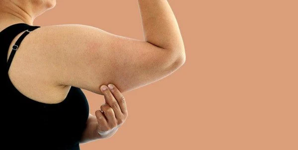 Toning Bingo Wings West Thurrock Effective Exercises and Tips for Achieving Sleeker Arms