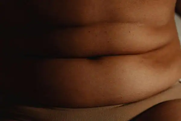 The Hidden Connection: How Stress Shapes Your Fitness and Body Composition 3 image of what stress can do on the stomach area and how Lipo 360 West Thurrock can help to change your body shape.