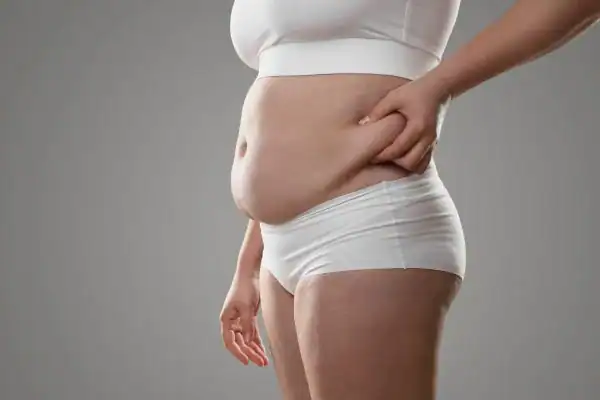Image of stress belly West Thurrock How Lipo 360 can help manage your symptoms